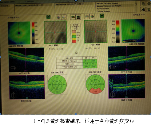 IC~KIML)U10FQ[L}7(I88CF.png