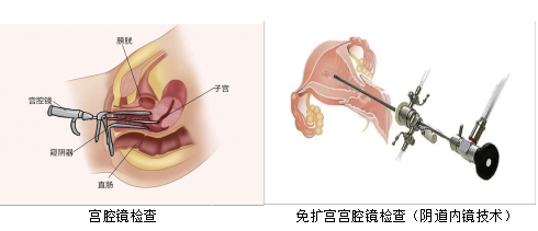 2026040315111907.png 阴道内镜技术.png